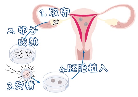 代怀生子机构